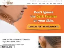 Sites similar to hearyourskin.in
