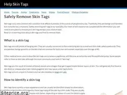 Sites similar to helpskintags.com