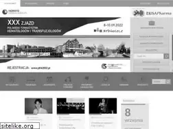 Sites similar to hematoonkologia.pl