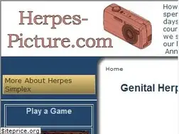 Sites similar to herpes-picture.com