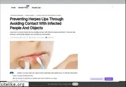 Sites similar to herpeslips.com