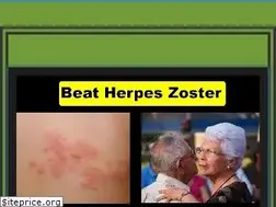 Sites similar to herpeszostersymptoms.com