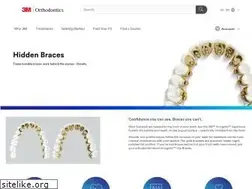 Sites similar to hiddenbraces.com
