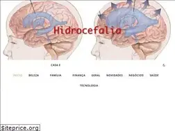 Sites similar to hidrocefalia.com.br