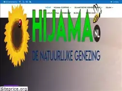 Sites similar to hijama.nl