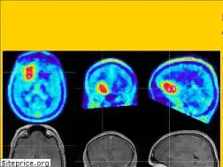 Sites similar to hirntumor.net