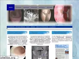 Sites similar to histeroscopia.es