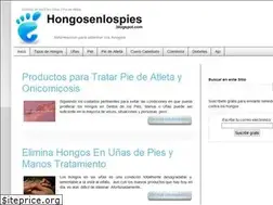 Sites similar to hongosenlospies.blogspot.com