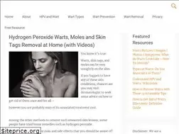 Sites similar to howtogetridofwartshome.com