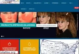 Sites similar to hyperhidrosis-usa.com