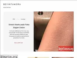 Sites similar to id.beyintumoru.org