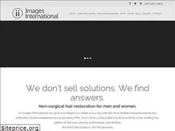 Sites similar to imageshairloss.com