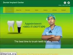 Sites similar to implant.com.bd