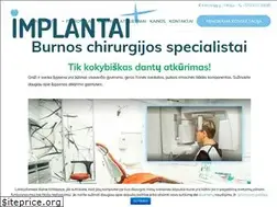 Sites similar to implantaiplius.lt