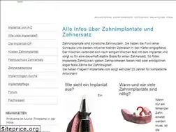 Sites similar to implantate.com