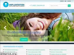 Sites similar to implantation.ru