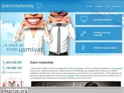 Sites similar to implantaty.net