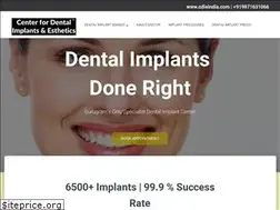 Sites similar to implantcenter.in