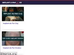 Sites similar to implantdepar.eu
