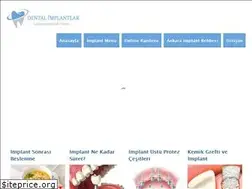 Sites similar to implantdisfiyatlari.gen.tr