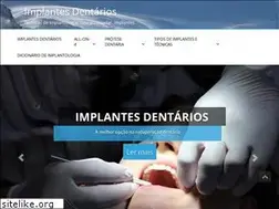 Sites similar to implante-dentario.pt