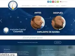 Sites similar to implantecapilar.com.co