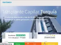 Sites similar to implantecapilarestambul.es