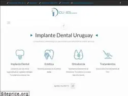 Sites similar to implantedentaluruguay.com