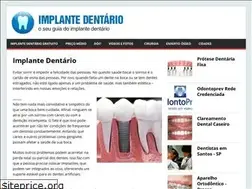 Sites similar to implantedentarioprecos.com.br
