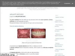 Sites similar to implantedentarios.blogspot.com