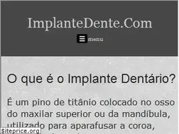 Sites similar to implantedente.com