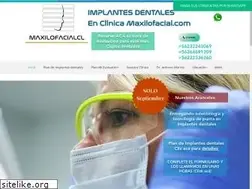 Sites similar to implantes.cl