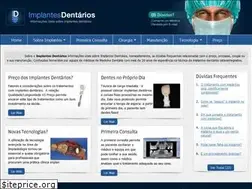 Sites similar to implantesdentarios.pt