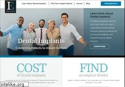 Sites similar to implantevolution.com