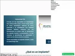 Sites similar to implantologiavina.cl