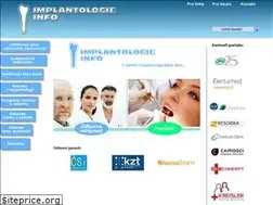 Sites similar to implantologie-info.cz