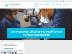Sites similar to implantoperio.com
