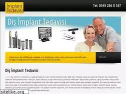 Sites similar to implanttedavisi.net