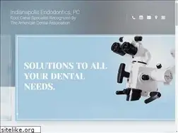 Sites similar to indyendo.com