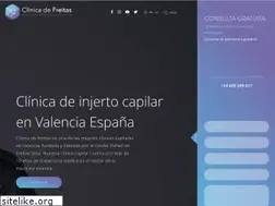 Sites similar to injertocapilar-alopecia.es