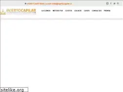 Sites similar to injertocapilar.cl
