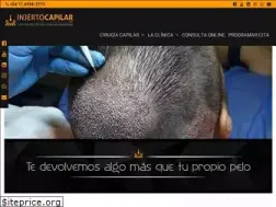 Sites similar to injertocapilar.com.ar