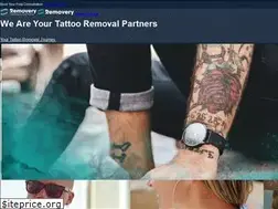 Sites similar to invisibleinktattooremovers.com