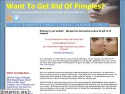 Sites similar to justgetridofpimples.com