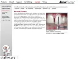 Sites similar to keramik-veneers.de