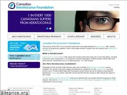 Sites similar to keratoconuscanada.org