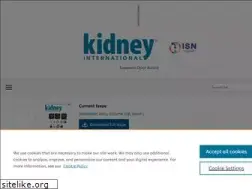 Sites similar to kidneyinternational-online.org