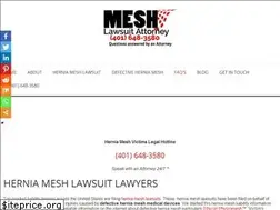 Sites similar to kugelherniameshclassaction.com
