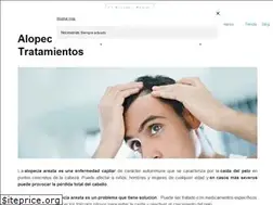 Sites similar to la-alopecia-areata.com