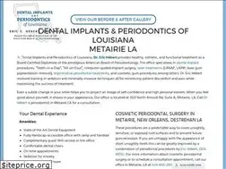 Sites similar to ladentalimplantsandperio.com